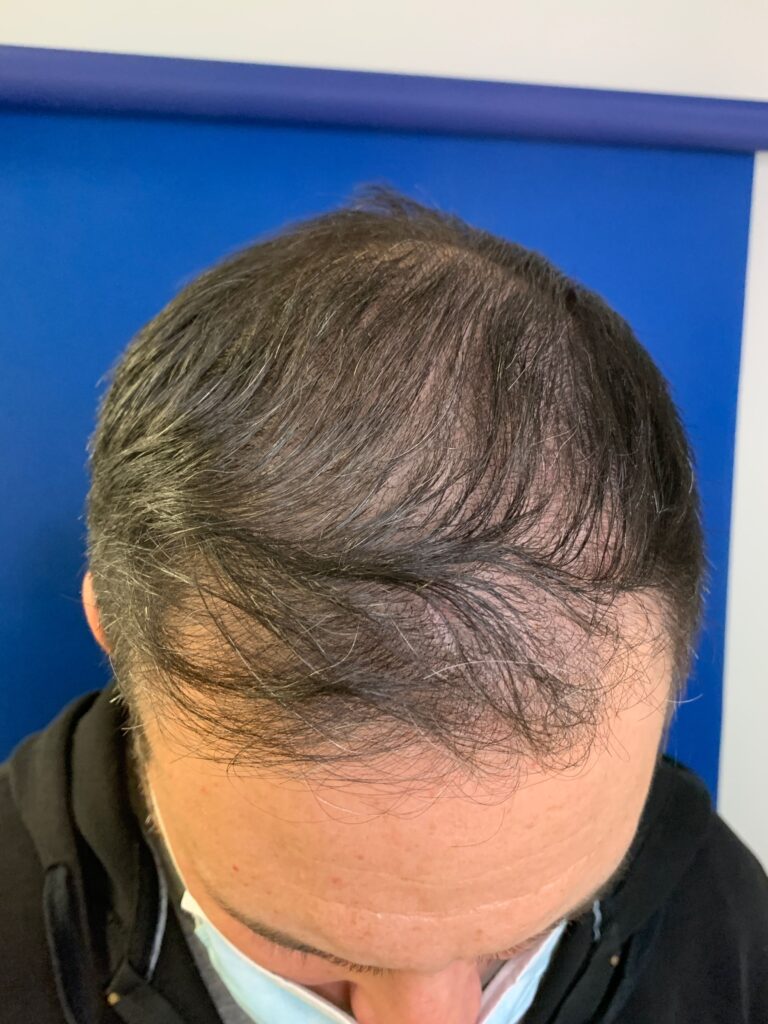Before